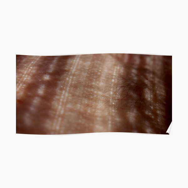 skin lace Poster