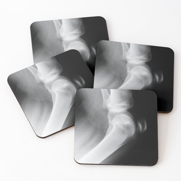 Item preview, joint x ray designed and sold by Ilze Lucero.