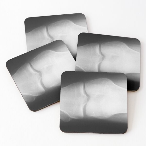 Item preview, Bone Xray designed and sold by Ilze Lucero.