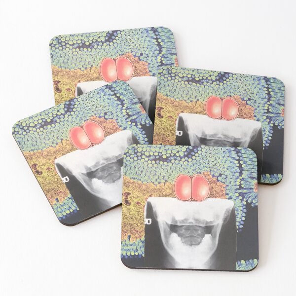 Item preview, X-ray, mouth, teeth, scream, anatomy, surreal, vintage, collage  designed and sold by AndyAltered.