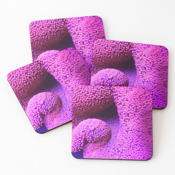 Item preview, Red Carpet Anemone designed and sold by buzzmarshall.