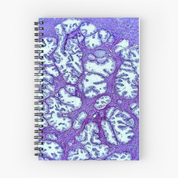 Item preview, Prostata tissue designed and sold by DarkiraVClemm.