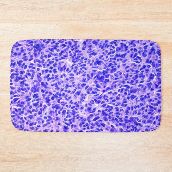 Item preview, Ovarian Dysgerminomas designed and sold by DarkiraVClemm.