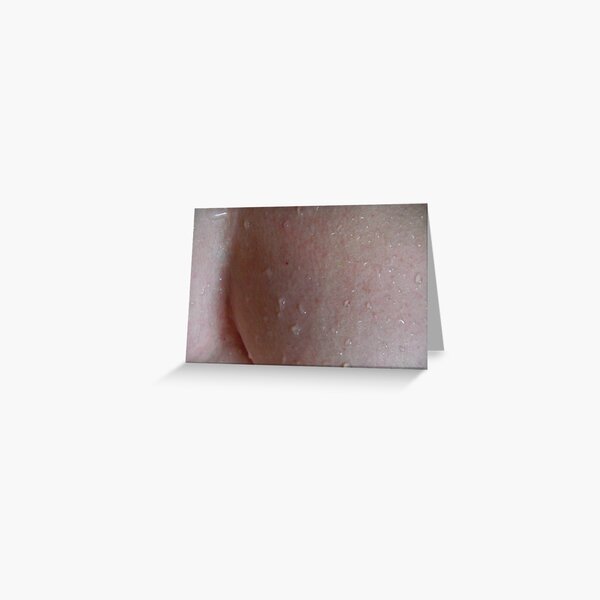 Body/Skin3 Greeting Card