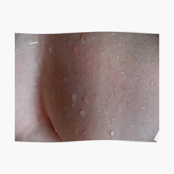 Body/Skin3 Poster