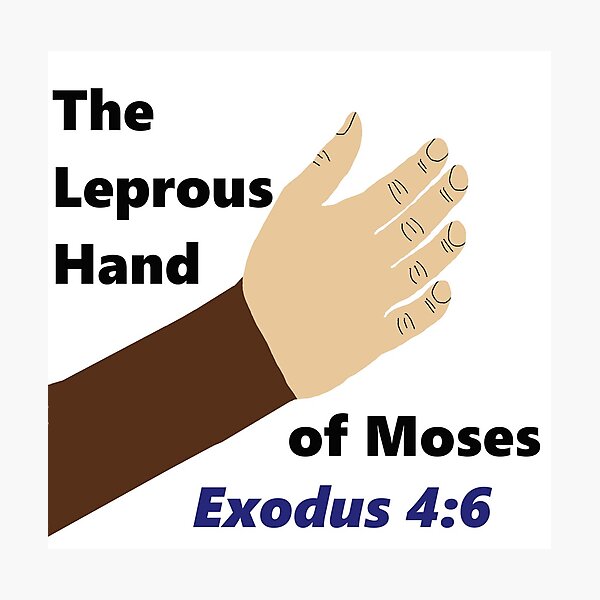 Moses was Black The Leprous Hand of Moses Exodus 4 6 Put now thine hand into thy bosom. Photographic Print for Sale by Sabrina Dawkins Redbubble