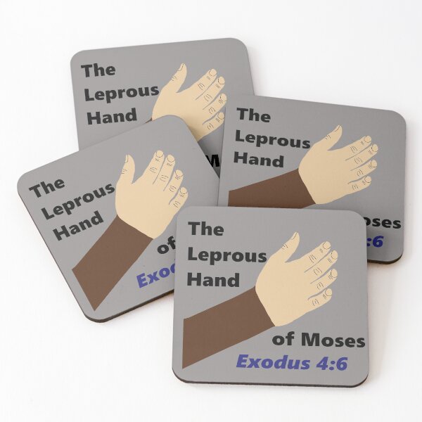 Item preview, Moses was Black - The Leprous Hand of Moses - Exodus 4:6 - Put now thine hand into thy bosom. designed and sold by Sabrina Dawkins.