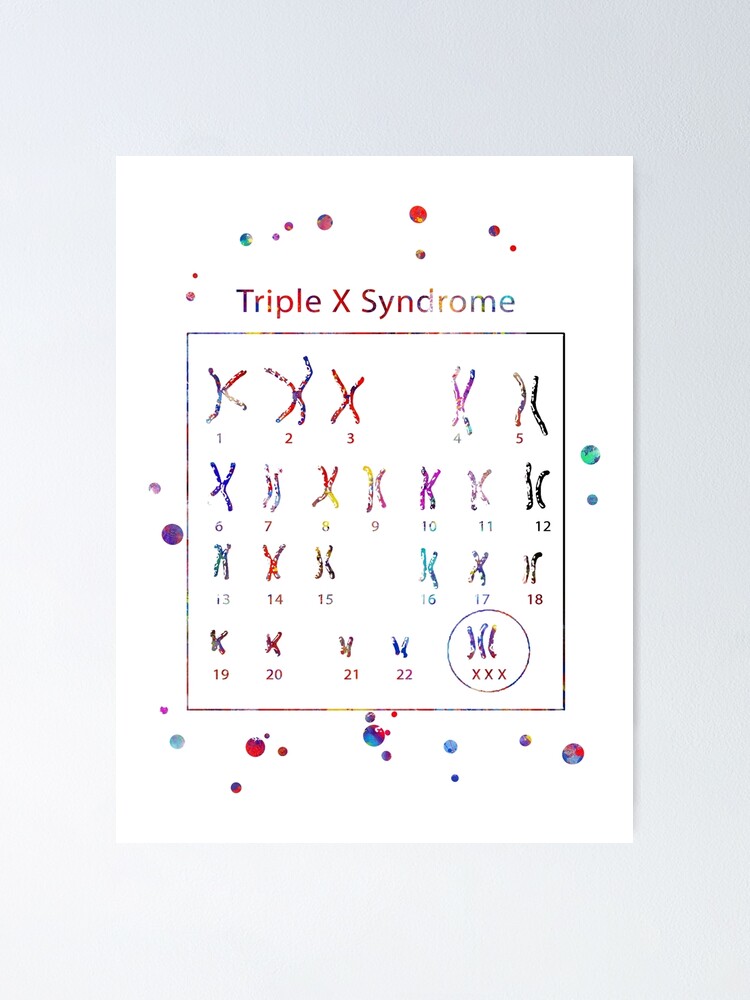 Triple x syndrome