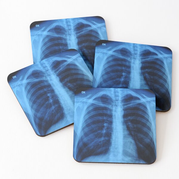 Item preview, X-Ray designed and sold by tony4urban.