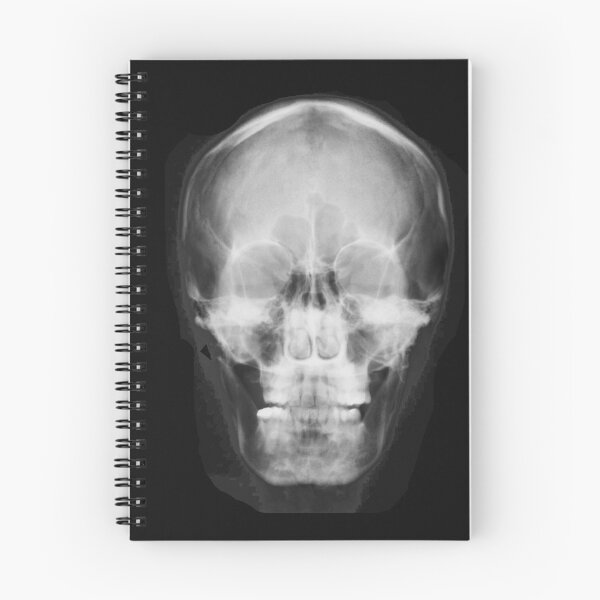 Item preview, Skull X-Ray Image designed and sold by Gift-It-Right.