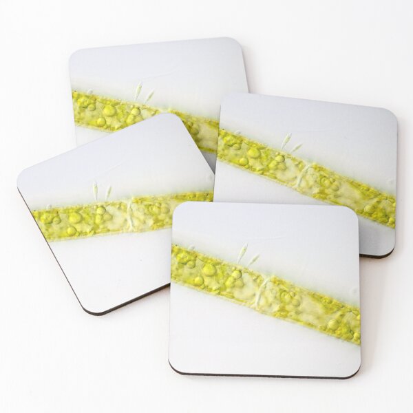 Item preview, Filamentous alga under the microscope designed and sold by SDym Photography.