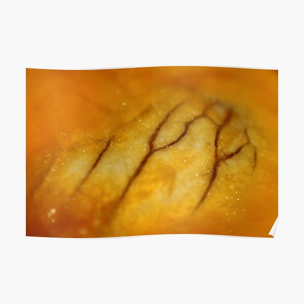 Veins (what is it?) Poster