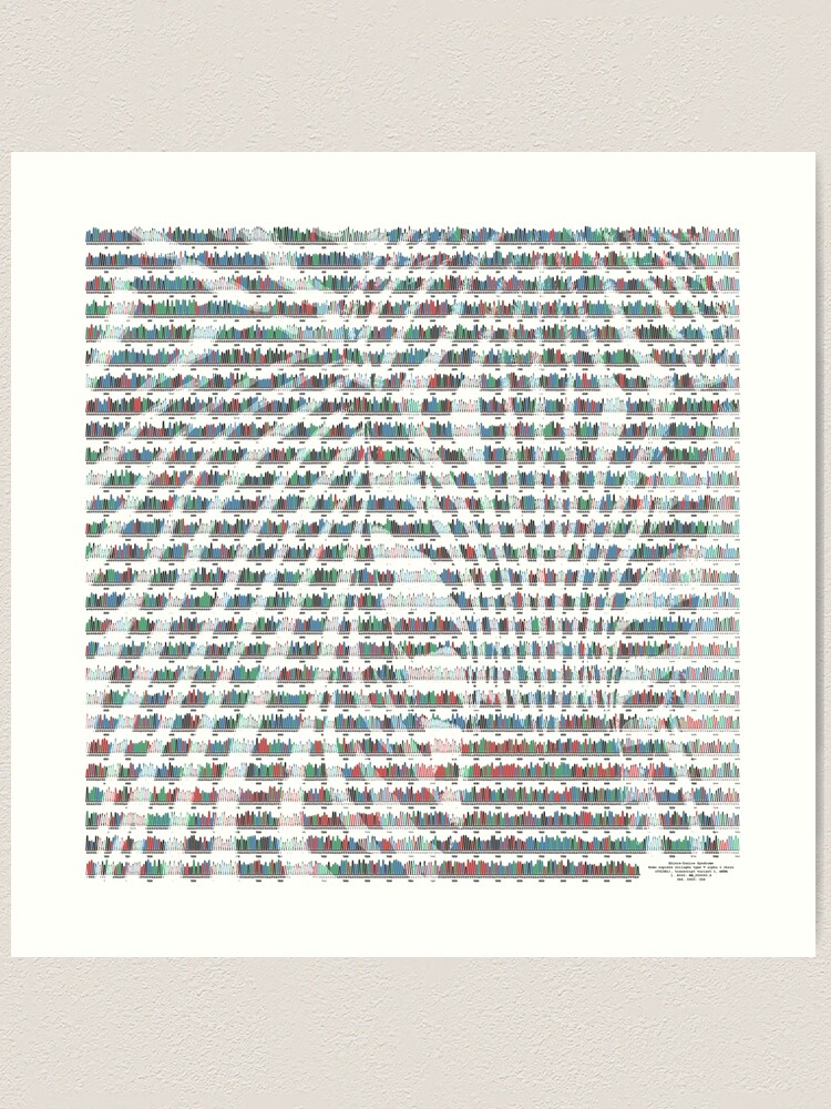 Alternate view of Ehlers Danlos Zebra Art Print