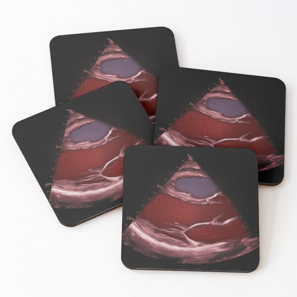 Item preview, PLAX 3D colour designed and sold by EchoArtUK.
